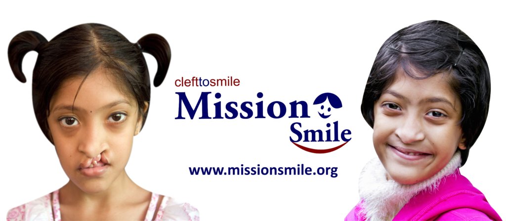 Establish Kolkata Comprehensive Cleft Care Centre