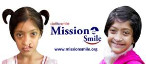 Establish Kolkata Comprehensive Cleft Care Centre