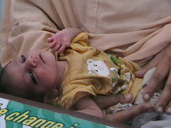 Father and his malnourished child, Swabi Camp