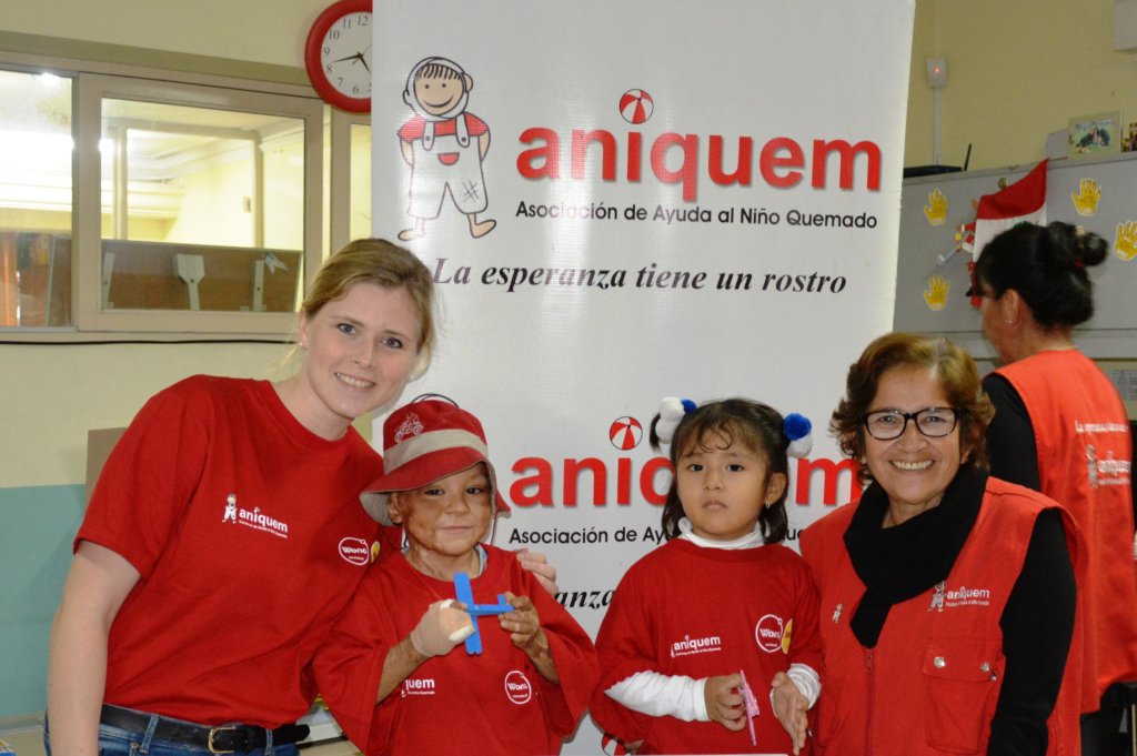 Help Jose-Give a burned child in Peru a new future
