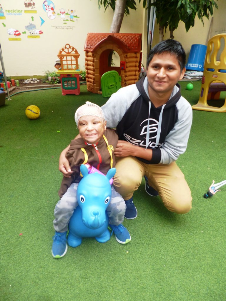 Help Jose-Give a burned child in Peru a new future