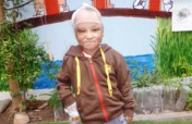 Help Jose-Give a burned child in Peru a new future