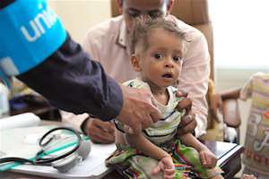 UNICEF health worker screens for malnutrition.
