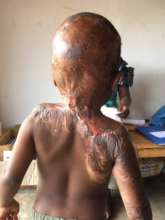 Wounds after plastic surgery