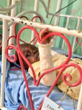 CHILD BURNT WHILE TRYING TO MAKE TEA