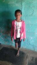 Nithyasiri prior to fitting the prosthesis