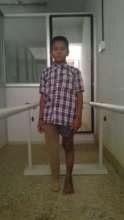 Shashank with his lower limb prosthesis