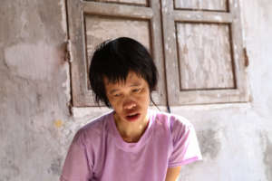Pham, 37, Agent Orange victim
