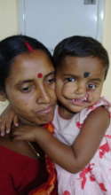 Ann before her surgery