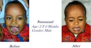 Nurmasud