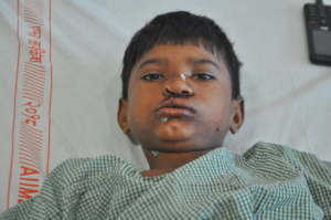 Rahul after his surgery