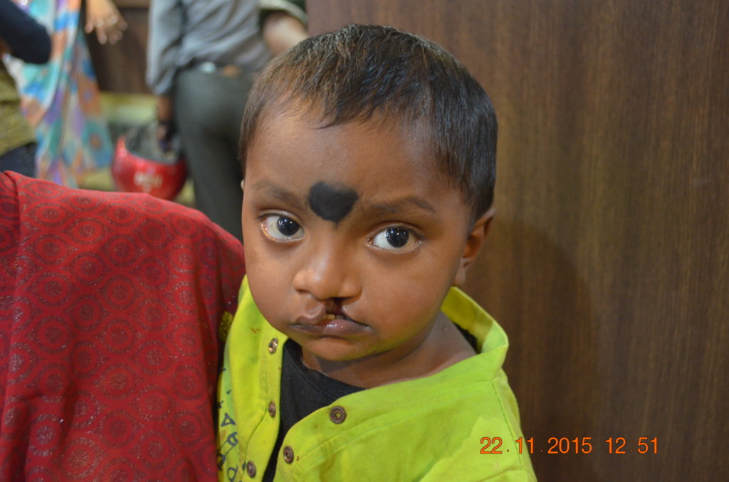 100 Smiles in 100 Days