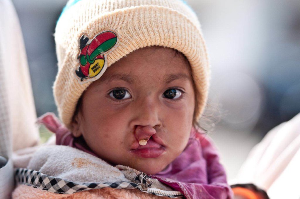 100 Smiles in 100 Days