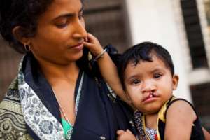 Samina with her mother waiting to get her Smile