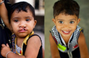 100 Smiles in 100 Days