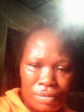 ONE OF THE VIOLENCE VICTIMS