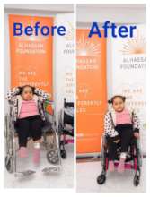 Sumaya receiving the customized wheelchair