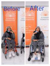 Mariam receiving the customized wheelchair