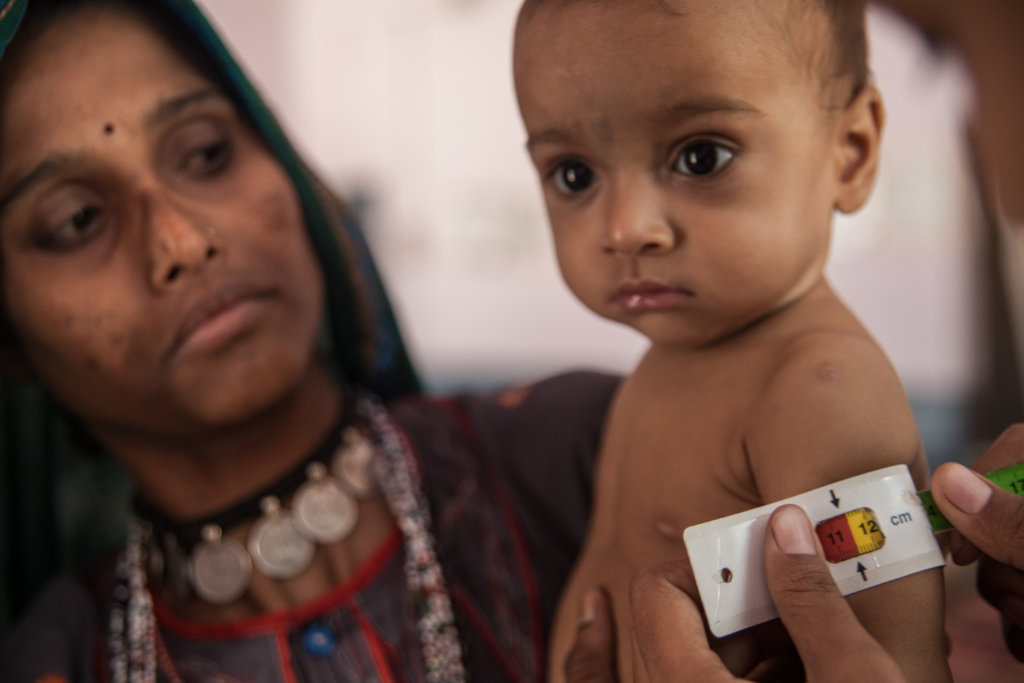 Save Lives of Malnourished Children in Rajasthan
