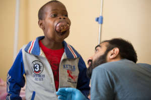 Hafis Before his Surgery