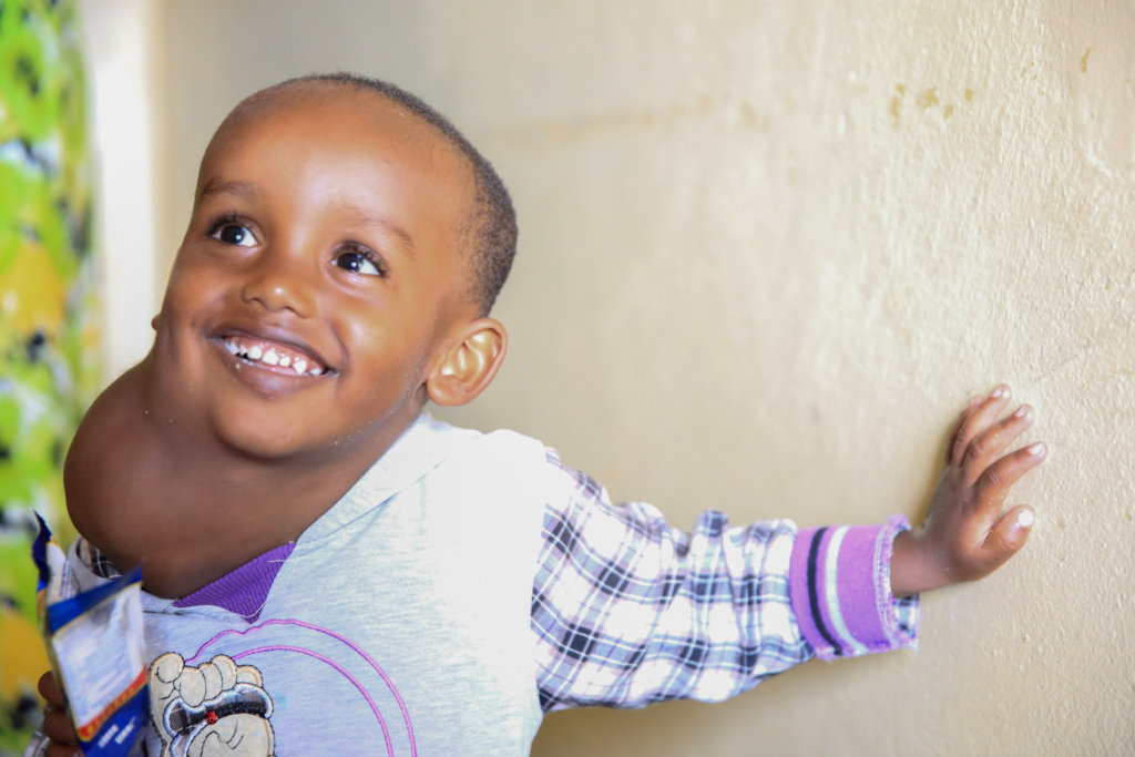 Support Facial Surgery for 50 Ethiopian Children