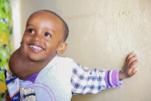 Khalid before his Surgery
