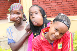 Support Facial Surgery for 50 Ethiopian Children