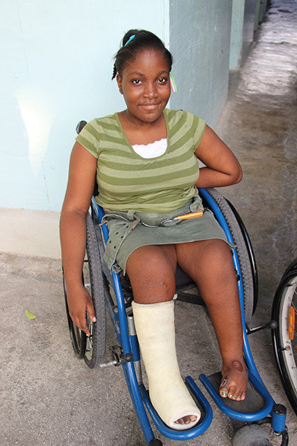 Christina after 1st surgery (August 2013)