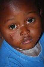 Stanley, an orphan with sickle cell anemia