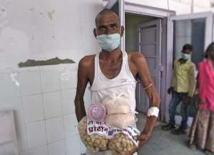 Humanity; Relief to Poor TB Patients