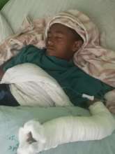 Alemu sleeping after his surgery at Cure Hospital