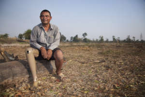 Lann lost his leg to a landmine.