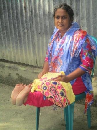 Support for Changes livelihood of Disabled Women