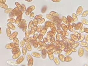 Microscopic image showing Rhodomonas cells