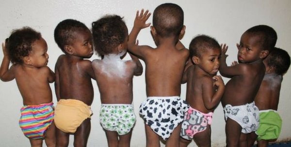Diapers for Children Recovering From Malnutrition