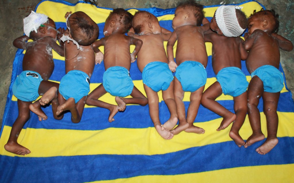 Diapers for Children Recovering From Malnutrition