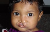 Fund Critical Medical Equipments for safe surgery