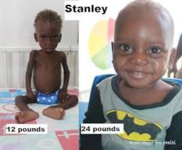 Stanley, at arrival and after inpatient care