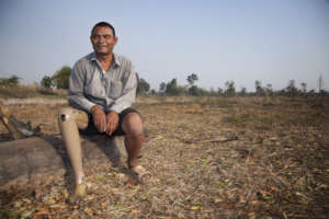 Lann lost a leg by standing on a mine.