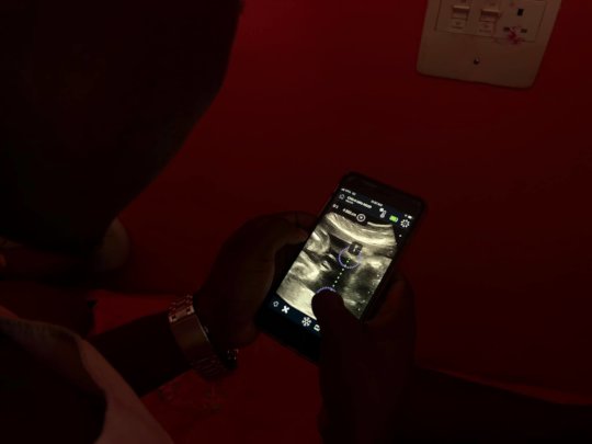 Image on a mobile phone during portable scan
