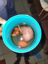 The lump removed from the patient