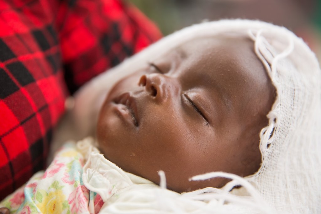 Support Maternal Health in Rural Haiti