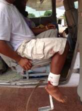 An injured man awaits departure.