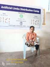 Lost Limb in Acciedent