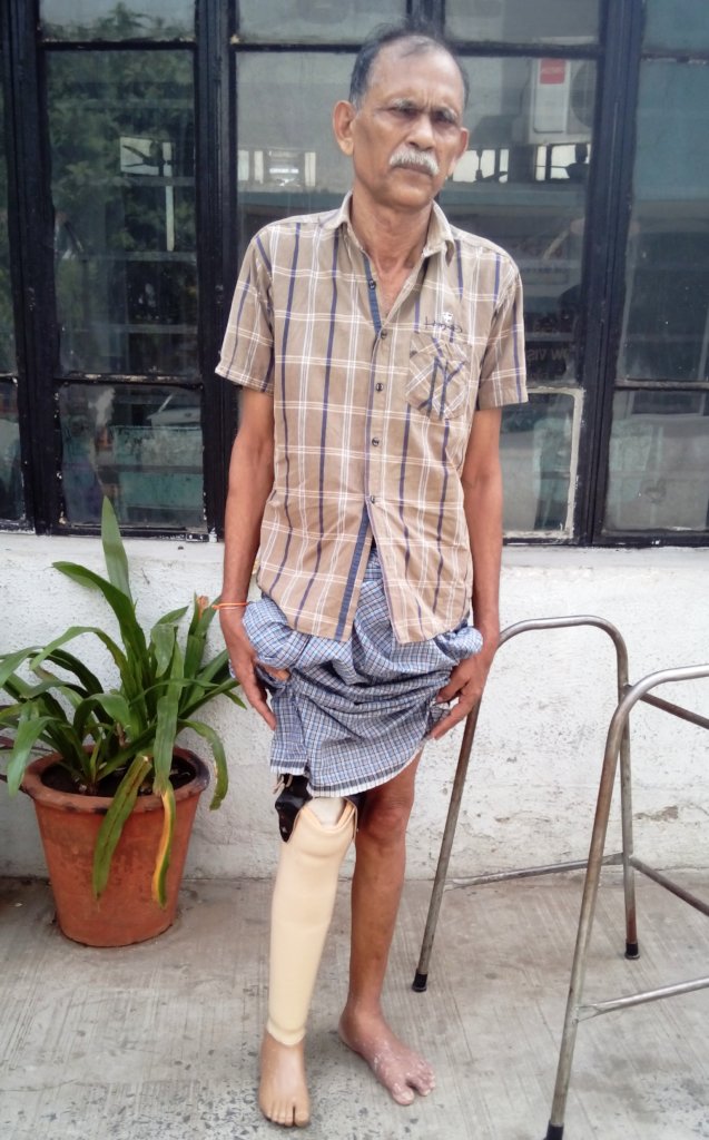 Assistive Device support to 1000 Disabled Persons