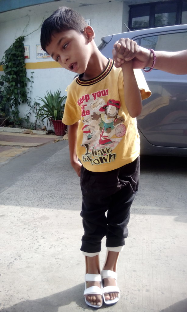 Assistive Device support to 1000 Disabled Persons