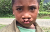 Assisting Children with Disabilities