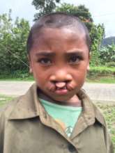 Assisting Children with Disabilities