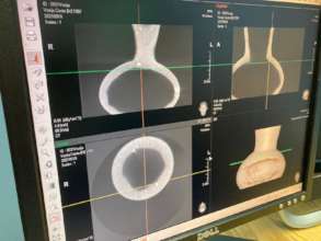 The results of one CBCT scan on a ceramic