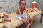 Treatment of 500 Yemeni handicapped children